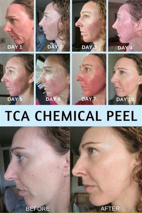Peptide Eye Cream Bulk Sourcing Guide Purity Specifications Certifications Manufacturing